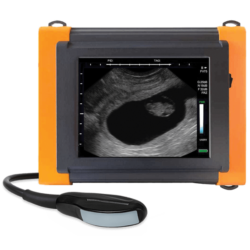 Ecografo IBEX SUPERLITE/c HR con sonda lineare-convex